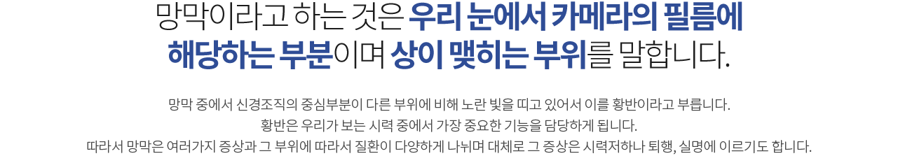 망막이라고 하는 것은 우리 눈에서 카메라의 필름에 해당하는 부분이며 상이 맺히는 부위를 말합니다.