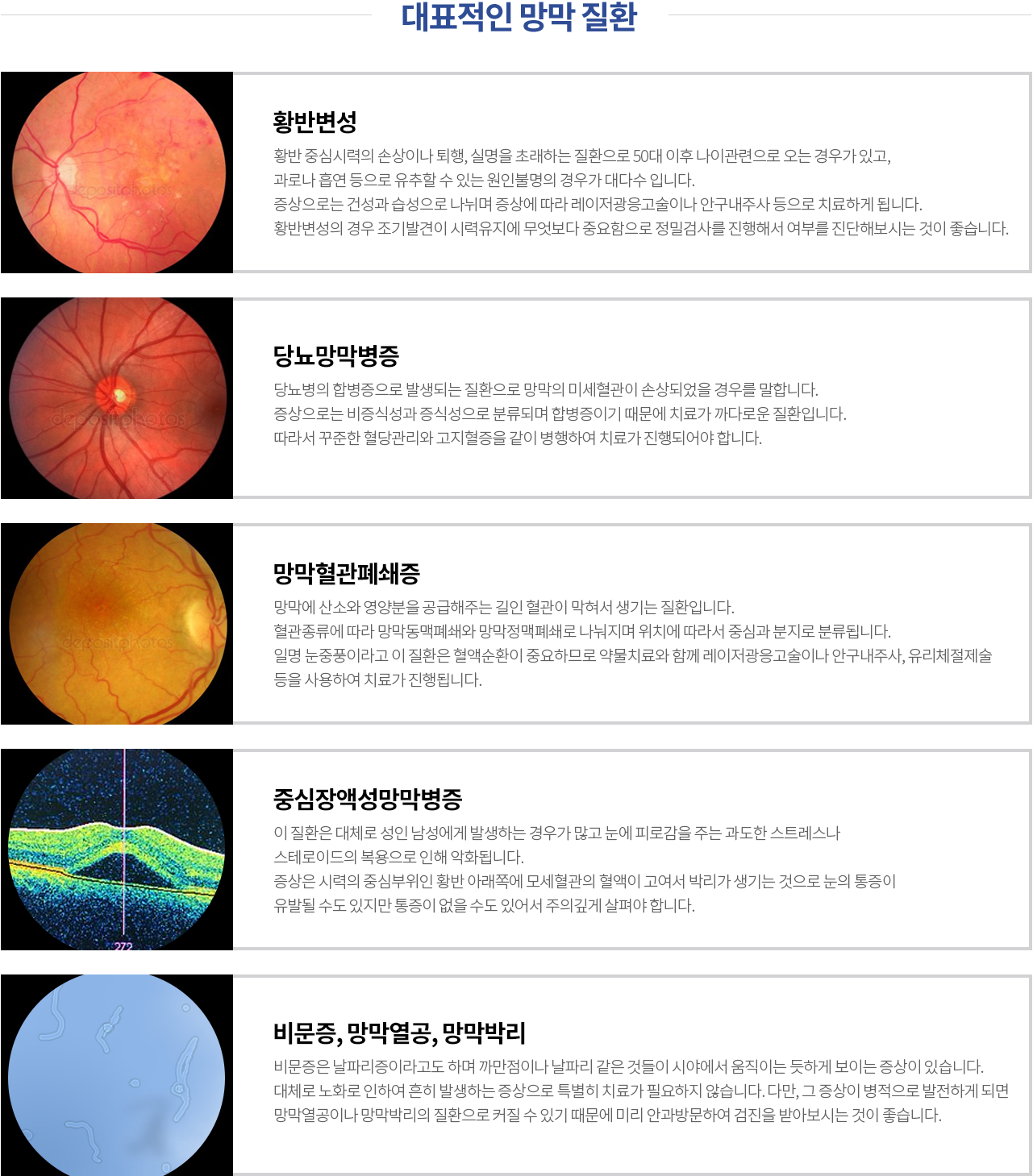 대표적인 망막 질환