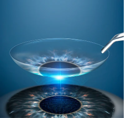 초정밀 분석 시스템